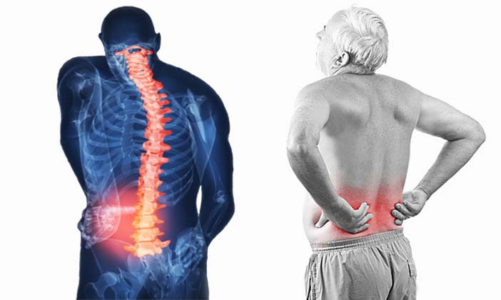 Programas crónicas y para encamados de fisioterapia en Madrid a domicilio